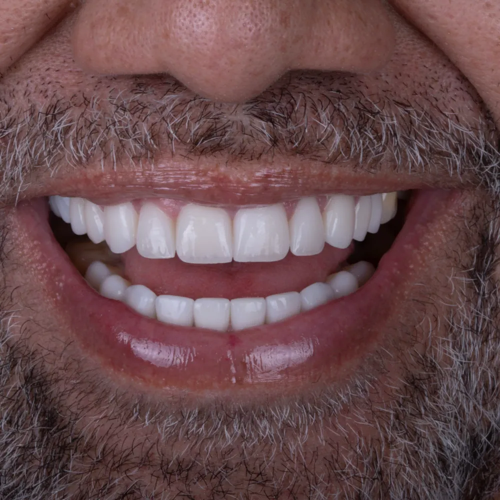 Smile with Smile Forever polyresin